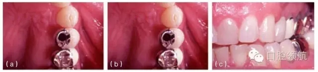 11.webp.jpg 11.webp.jpg