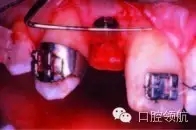 17.webp.jpg 17.webp.jpg