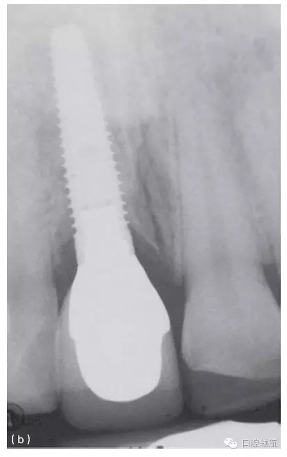 19.webp.jpg 19.webp.jpg