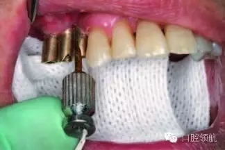 40.webp.jpg 40.webp.jpg