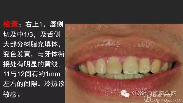 640.webp (1).jpg 640.webp (1).jpg