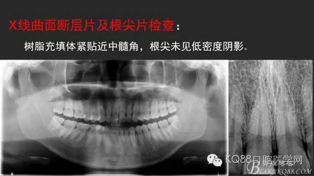 640.webp (2).jpg 640.webp (2).jpg