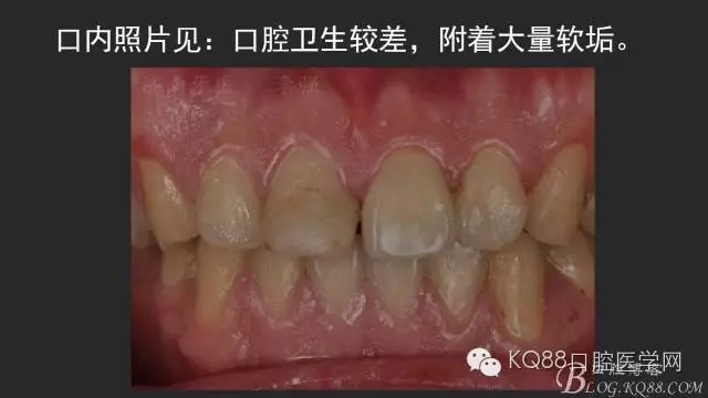 640.webp (3).jpg 640.webp (3).jpg