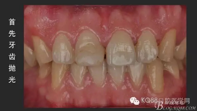 640.webp (9).jpg 640.webp (9).jpg