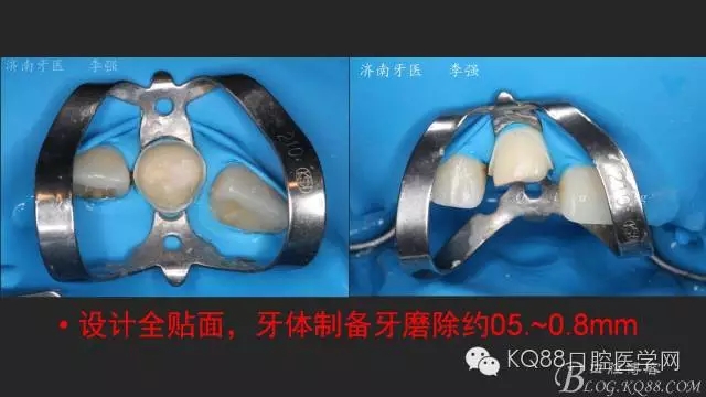 640.webp (15).jpg 640.webp (15).jpg