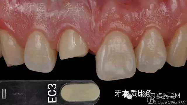 640.webp (16).jpg 640.webp (16).jpg