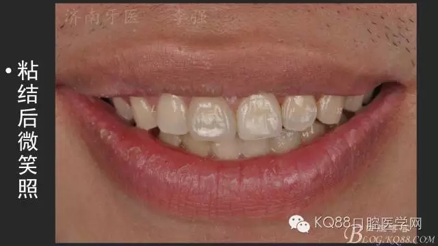 640.webp (23).jpg 640.webp (23).jpg