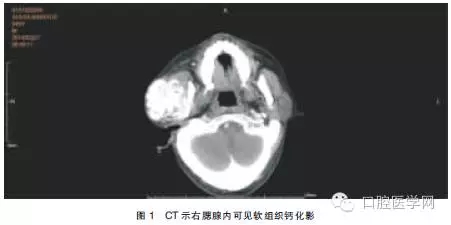 4.webp.jpg 4.webp.jpg