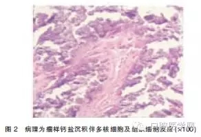 5.webp.jpg 5.webp.jpg