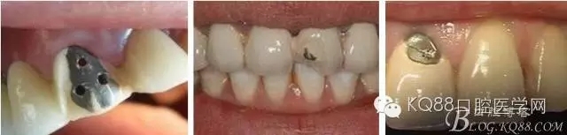 4.webp.jpg 4.webp.jpg