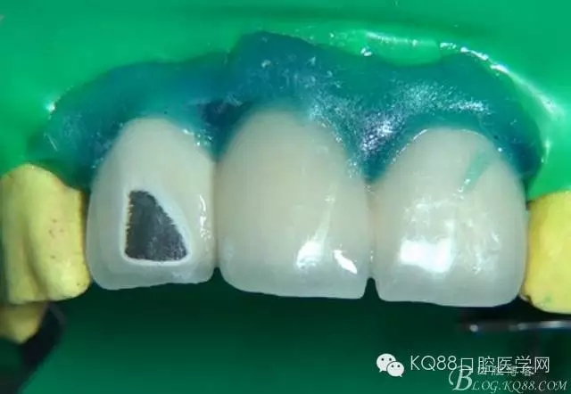 16.webp.jpg 16.webp.jpg