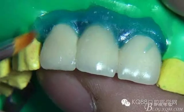 24.webp.jpg 24.webp.jpg