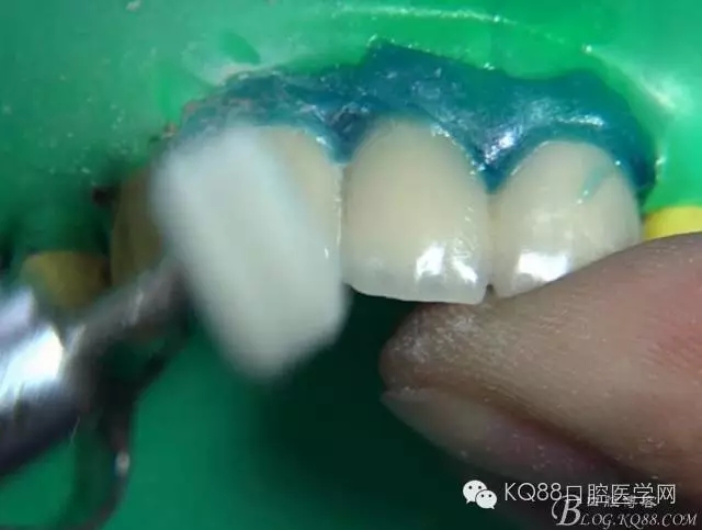 31.webp.jpg 31.webp.jpg