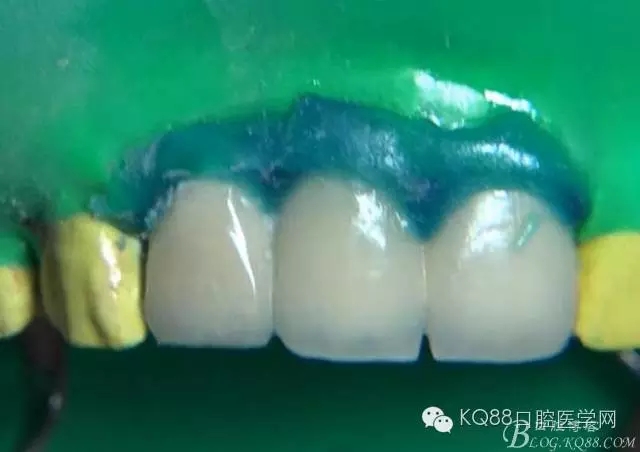 32.webp.jpg 32.webp.jpg