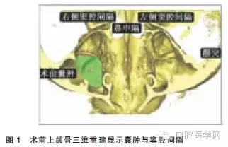 640.webp.jpg 640.webp.jpg