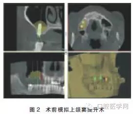 640.webp (1).jpg 640.webp (1).jpg