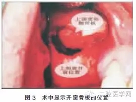 640.webp (2).jpg 640.webp (2).jpg