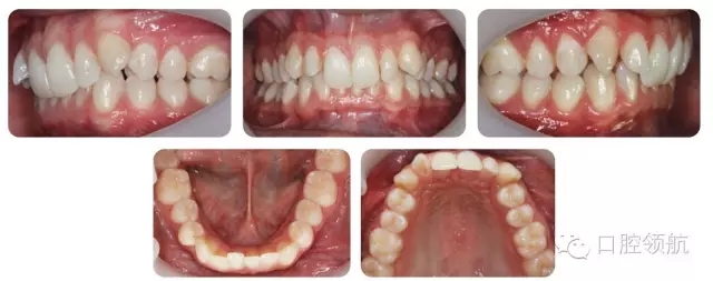 640.webp (8).jpg 640.webp (8).jpg