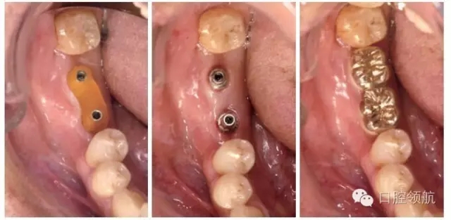 640.webp (3).jpg 640.webp (3).jpg