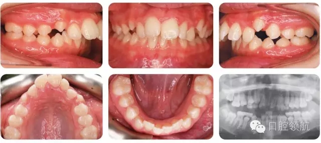 1.webp.jpg 1.webp.jpg