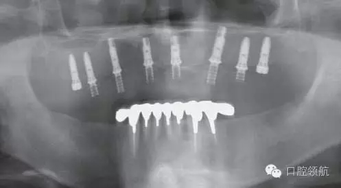 640.webp (2).jpg 640.webp (2).jpg