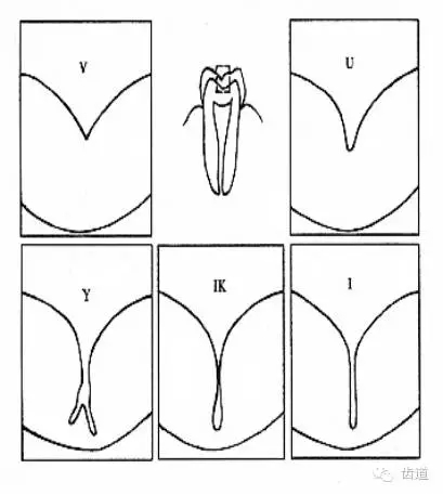 1.webp.jpg 1.webp.jpg