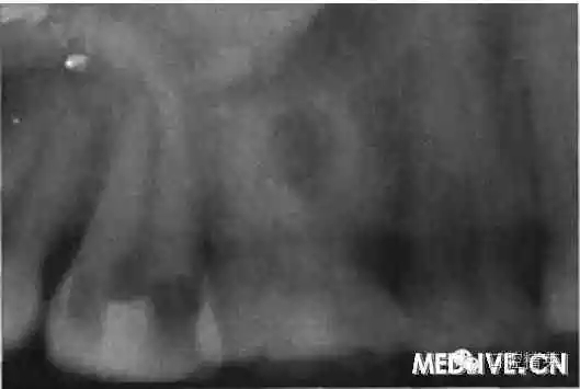 640.webp.jpg 640.webp.jpg