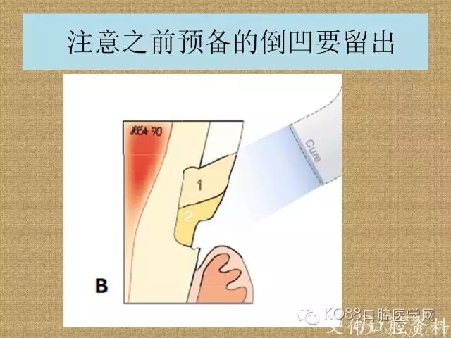 640.webp (16).jpg 640.webp (16).jpg