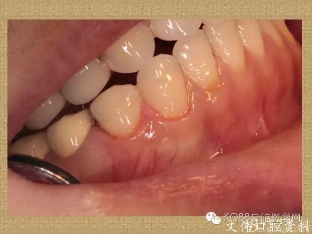 640.webp (41).jpg 640.webp (41).jpg