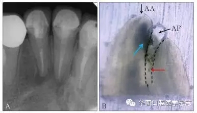 4.webp.jpg 4.webp.jpg