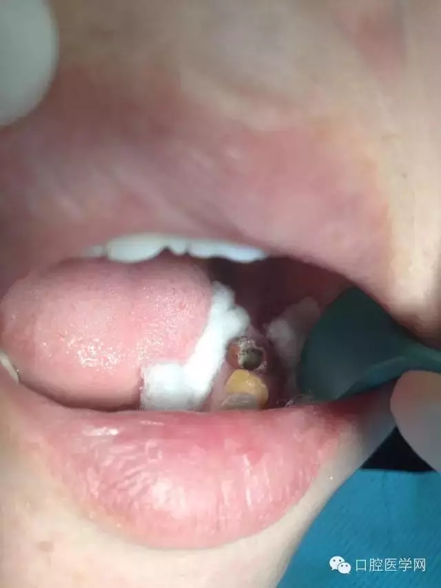 640.webp.jpg 640.webp.jpg