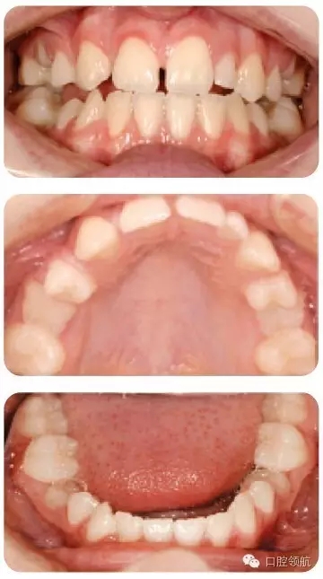 640.webp (3).jpg 640.webp (3).jpg