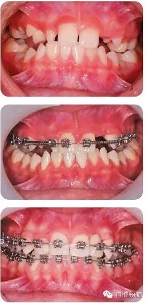 640.webp (5).jpg 640.webp (5).jpg