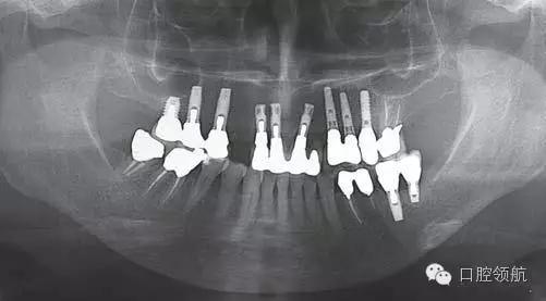 640.webp (1).jpg 640.webp (1).jpg