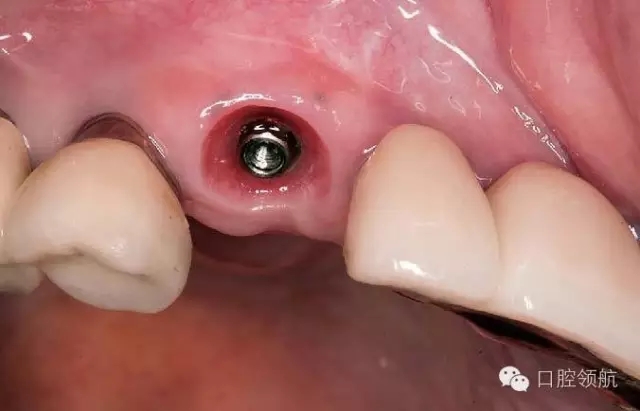 640.webp (3).jpg 640.webp (3).jpg