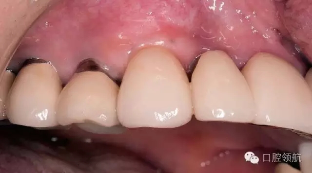 640.webp (5).jpg 640.webp (5).jpg