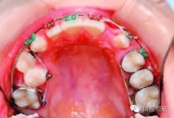 640.webp (2).jpg 640.webp (2).jpg