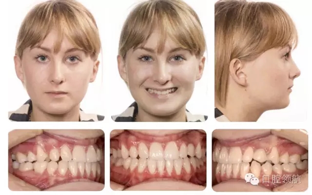 640.webp (4).jpg 640.webp (4).jpg