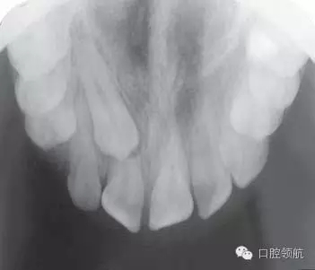 640.webp (1).jpg 640.webp (1).jpg