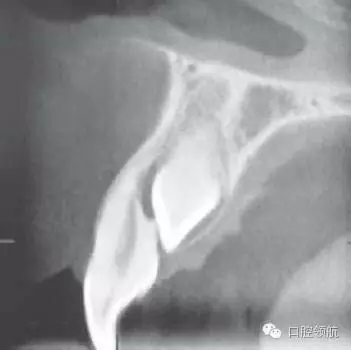 640.webp (2).jpg 640.webp (2).jpg