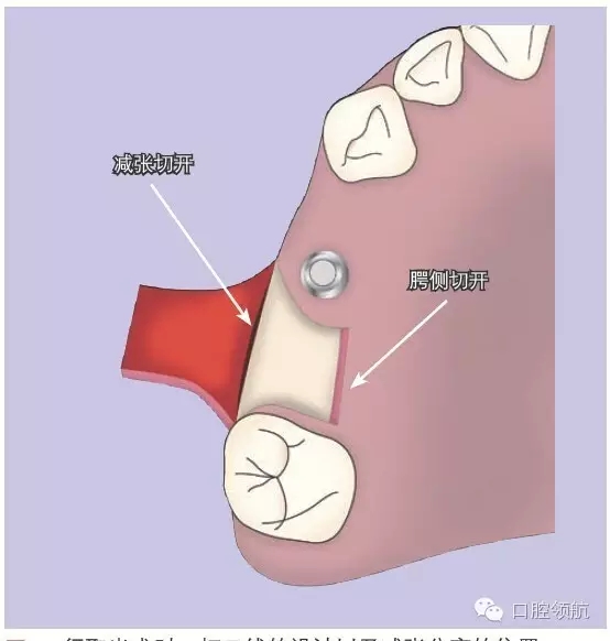 640.webp (2).jpg 640.webp (2).jpg