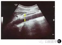 640.webp.jpg 640.webp.jpg