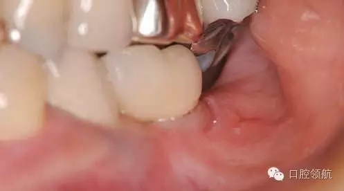 640.webp (1).jpg 640.webp (1).jpg