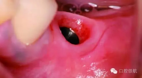 640.webp (6).jpg 640.webp (6).jpg