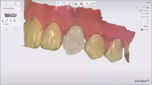 640.webp (1).jpg 640.webp (1).jpg