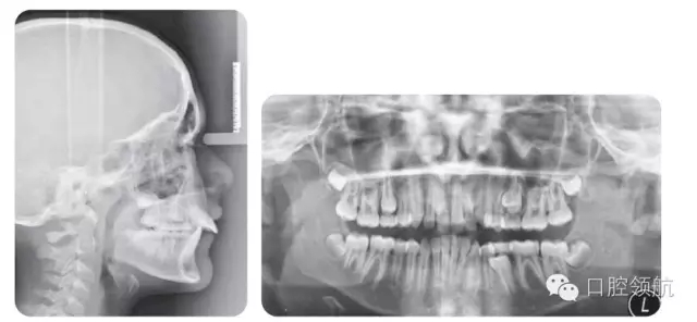 640.webp (2).jpg 640.webp (2).jpg