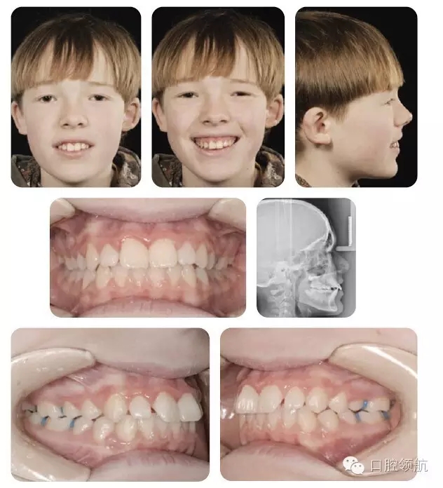 640.webp (3).jpg 640.webp (3).jpg