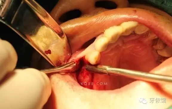 640.webp (1).jpg 640.webp (1).jpg