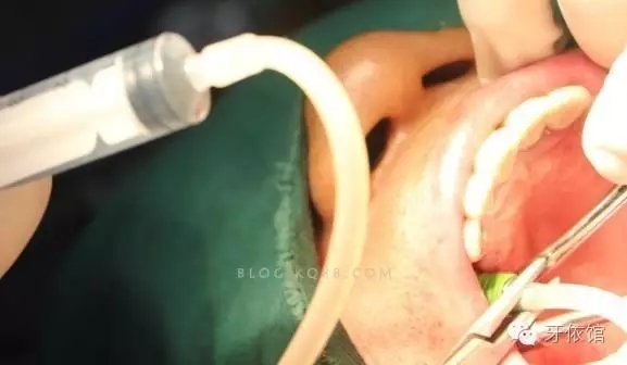 640.webp (3).jpg 640.webp (3).jpg