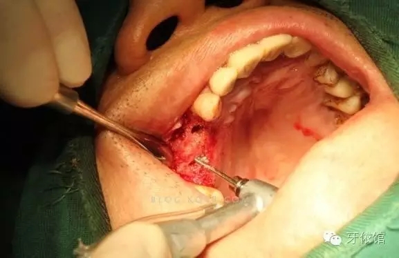 640.webp (11).jpg 640.webp (11).jpg